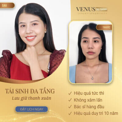  Tái sinh đa tầng Venus by Asian với nhiều ưu điểm nổi trội